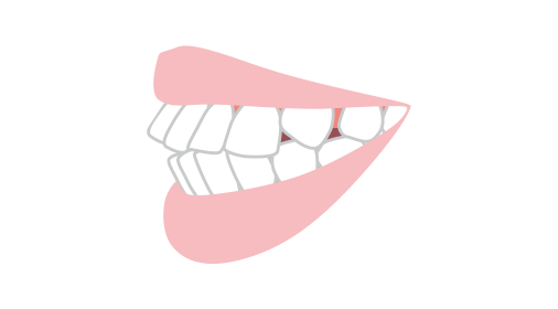 上下顎前突イメージ